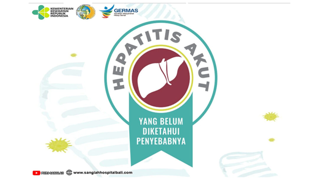 Kini Muncul Virus Hepatitis Akut Misterius, Lantas Apa Yang Harus ...